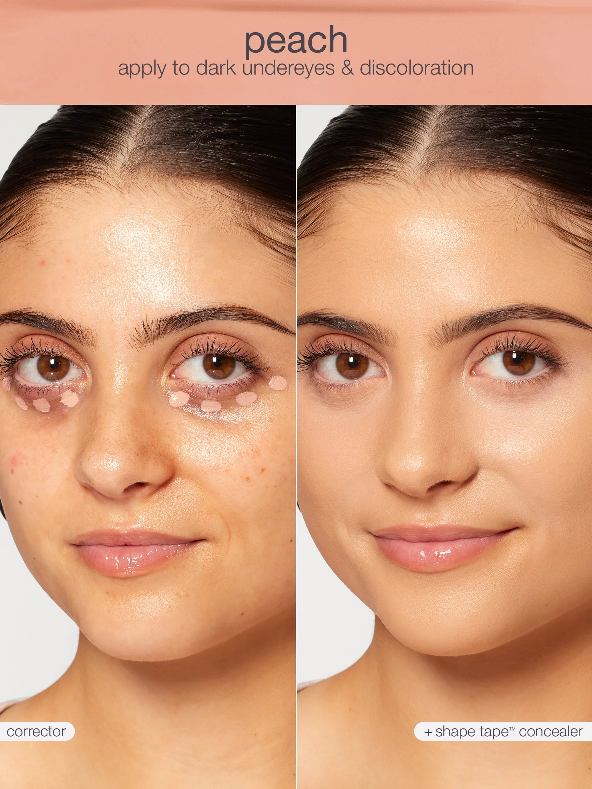shape tape™ corrector - Image 24